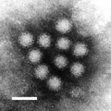 Norovirus, imaged by negative-stain Transmission Electron Microscopy. The bar scale is 50 nanometers