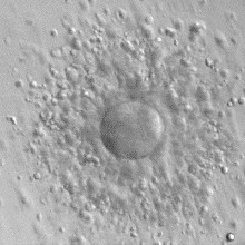 Human oocyte (egg cell) with surrounding granulosa cells, after aspiration