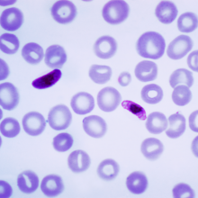  This photomicrograph of a blood smear contains a macro- and microgametocyte of the Plasmodium falciparum parasite. Both macro- and microgametocytes are products of the erythrocytic life cycle. Within a few minutes after the Anopheles sp. vector...