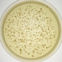 Bacterial culture as sampled from from a toilet seat