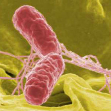 False colour SEM of Salmonella bacteria