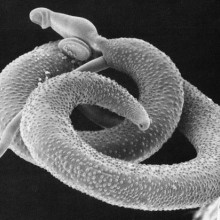 Schistosoma mansoni, the cause of the disease bilharzia
