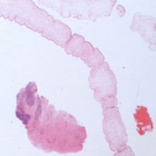 Unsegmented ribbon of worm next to fragments of inflamed brain