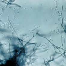 Streptomyces Streptomyces