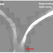  This slide is the composite images from multiple sections that cover both control and injured eyes, optic nerves and the chiasm. In contrast to the control, where no regenerating axons pass the lesion site in the left, PTEN/SOCS3 double deletion...