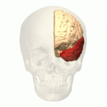 left temporal lobe