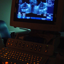 Ultrasound Ultrasound