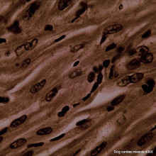 cardiac muscle