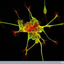 New Nerve Cells