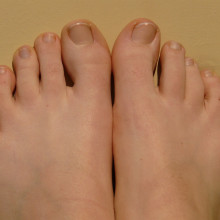 Toenails