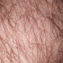 Some hair Some hair, ideally short and clean