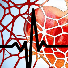 A cartoon heart overlaid by a network of blood vessels and an ECG (electrocardiogram)