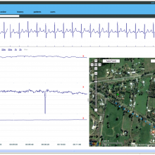 Screen-shot of server-side display of exercise data