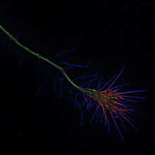 Cannabinoid receptor