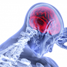 A X-ray image of figure clutching their head, with their brain glowing in red.