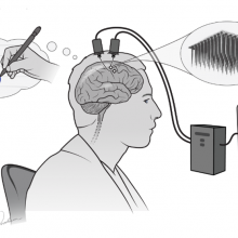 A brain-computer interface detects patterns of nerve activity in the motor cortex and interprets them as handwritten letters