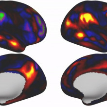 The shape and exact location of certain brain regions is linked to intelligence, life satisfaction and other behavioural factors.