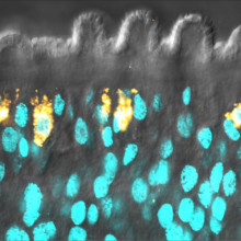 Schistosome stem cells