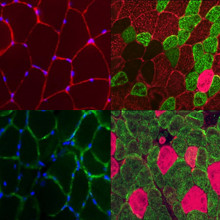 Gastrocnemius muscle in a mouse