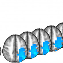 Intraparietal sulcus