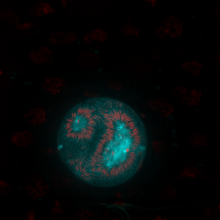 A protein called TRP1 allows the parasites that cause malaria to move around inside mosquitoes.