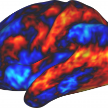 Studying the effects of LSD on the brain may help to find new treatments for mental health disorders.