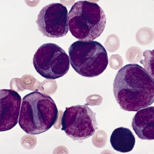 Myeloid Leukaemia cells