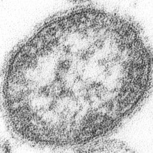 A measles virus particle (virion). The measles virus is a paramyxovirus, of the genus Morbillivirus. It is 100-200 nm in diameter, with a core of single-stranded RNA, and is closely related to the rinderpest and canine distemper viruses.