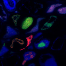 Multipartite virus replicating different components in different cells