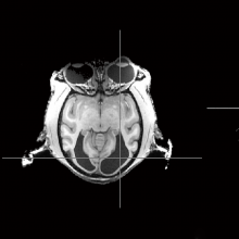 Brain scan of a monkey that could still see but lacked a primary visual cortex