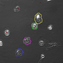 For a tuberculosis infection to progress, around 50 bacterial cells need to infect a single immune cell.