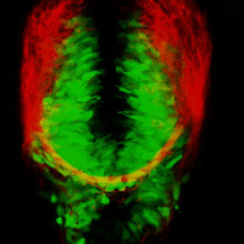 Green inhibitory and red excitatory cells glowing in a live zebrafish brain.