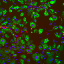 adipocytes