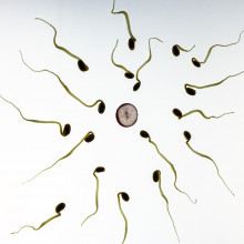 Sperm surrounding an egg cell.