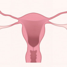 A cartoon representation of a uterus and ovaries