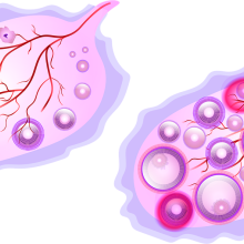 Graphic of the ovary with maturing follicles