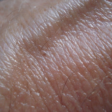 Skin close up