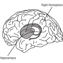 Cartoon of the brain showing the location of the hippocampus