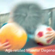 age related macular degeneration