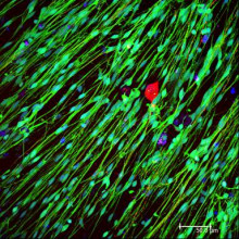 engineered neural tissue
