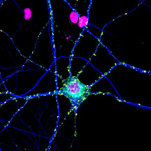 A single cell neuron