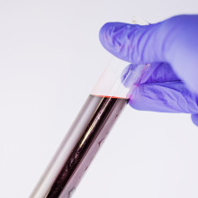 A test tube containing a blood sample