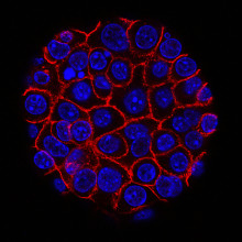 Pancreatic cancer cell Pancreatic cancer cell