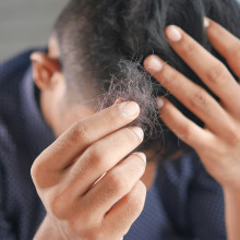 Hair loss