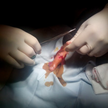 Suturing a patient's finger