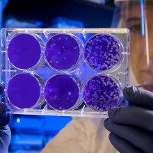 Person in laboratory looking at petri dish