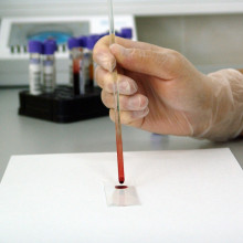 a blood sample on a slide in a lab