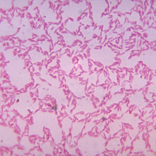Bacteroides biacutis, one of many commensal anaerobic Bacteroides spp. in the gastrointestinal tract.