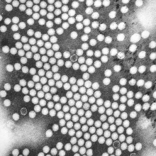 Electron micrograph of the poliovirus. Poliovirus is a species of Enterovirus, which is a Genus in the family of Picornaviridae, and is an RNA virus.