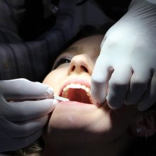 Dental Check